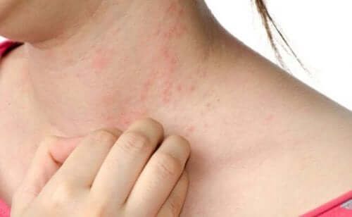 5-common-signs-of-sensitive-skin